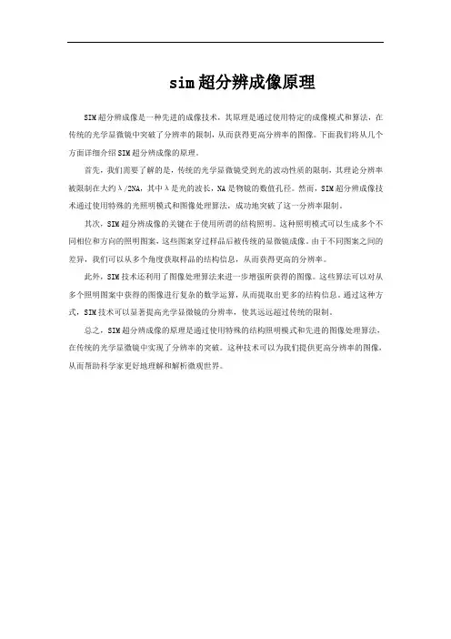 sim超分辨成像原理