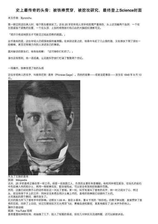 史上最传奇的头骨：被铁棒贯穿，被挖坟研究，最终登上Science封面