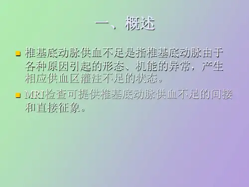 椎基底动脉供血不足的影像表现