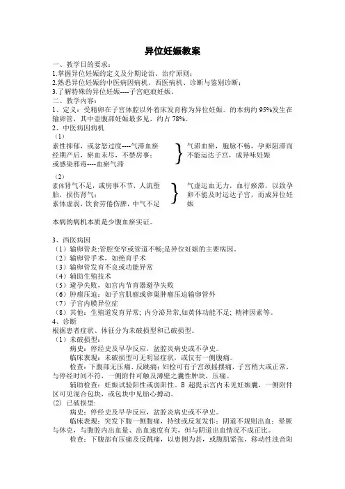 异位妊娠教案