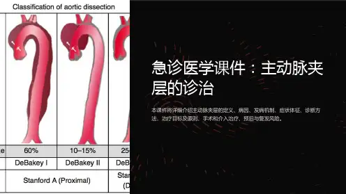 急诊医学课件：主动脉夹层的诊治