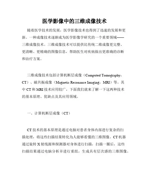 医学影像中的三维成像技术