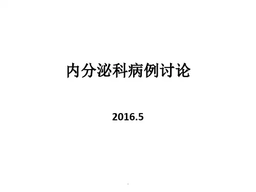 内分泌科病例分析教学