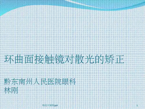 环曲面接触镜对散光的矫正