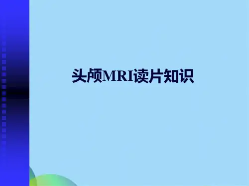 头颅MRI超好读片(共110张PPT)