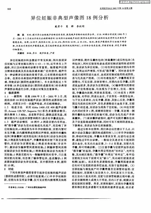 异位妊娠非典型声像图18例分析