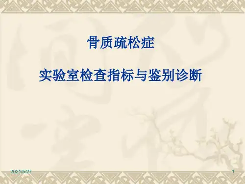 骨质疏松实验室检查与鉴别诊断
