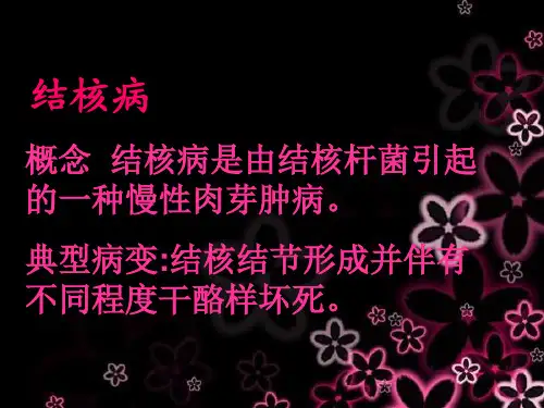 结核病
