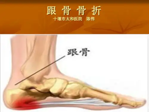 跟骨骨折护理