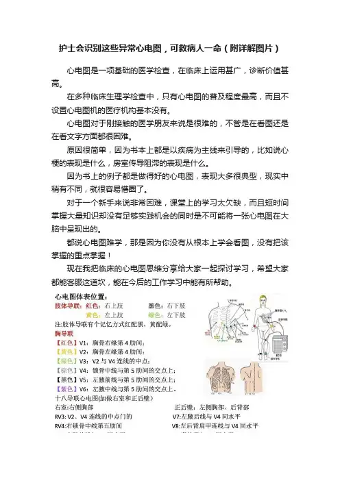 护士会识别这些异常心电图，可救病人一命（附详解图片）