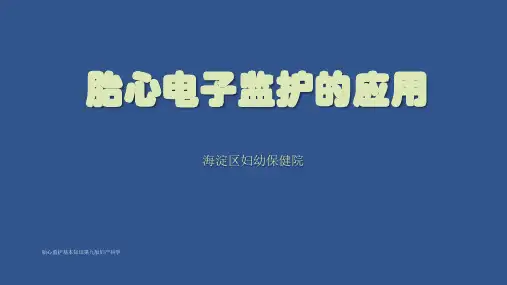 胎心监护基本知识第九版妇产科学