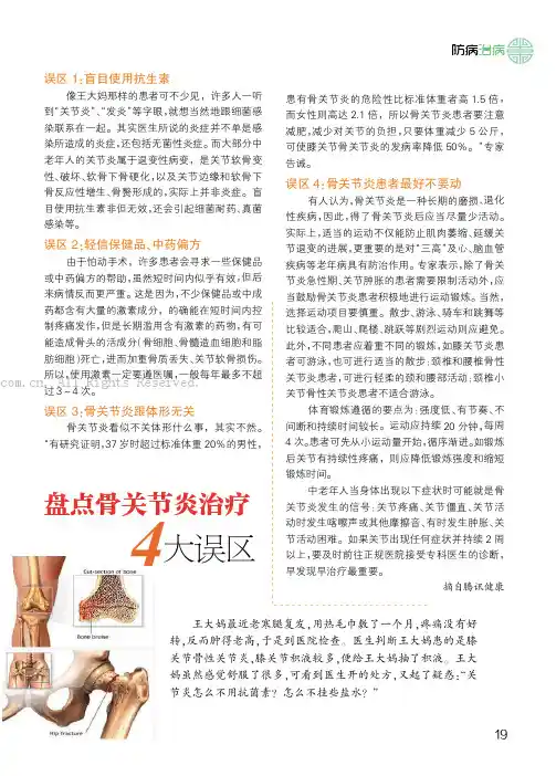盘点骨关节炎治疗4大误区