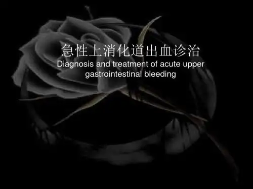 上消化道出血原因及处理PPT幻灯片课件