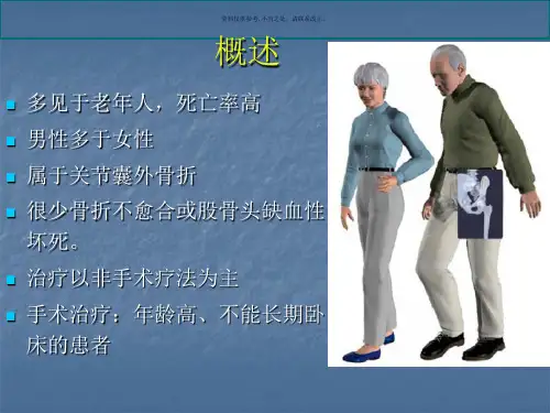 股骨转子间骨折医学知识