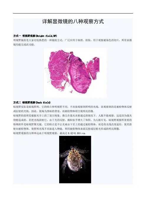 详解显微镜的八种观察方式