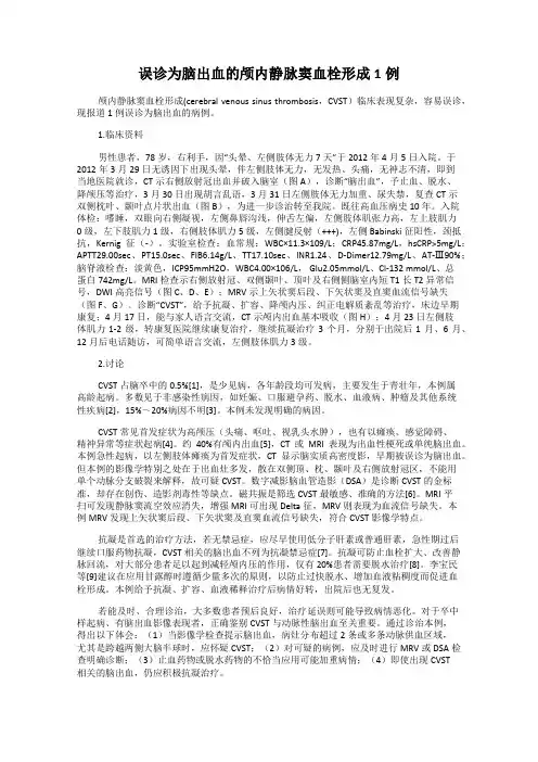 误诊为脑出血的颅内静脉窦血栓形成1例