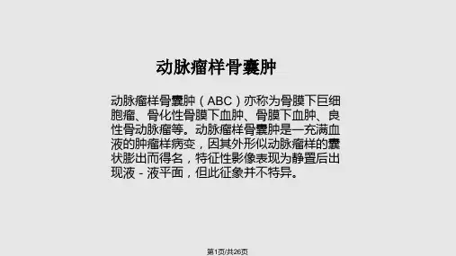动脉瘤样骨囊肿的影像学表现及鉴别诊断PPT课件
