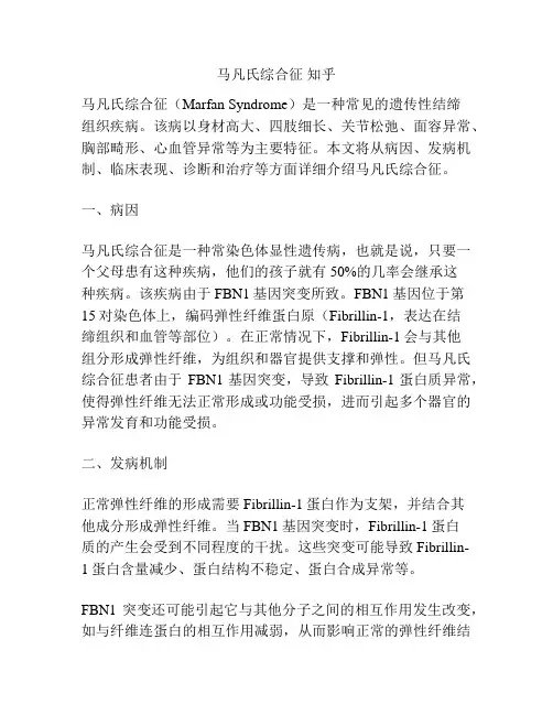 马凡氏综合征 知乎