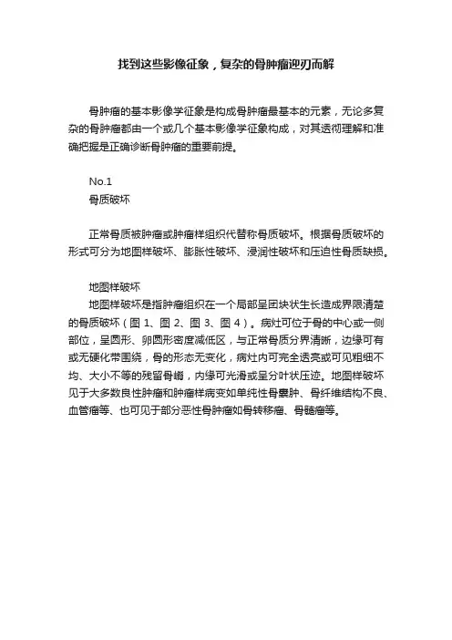 找到这些影像征象，复杂的骨肿瘤迎刃而解
