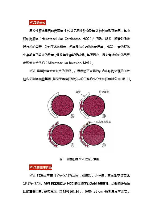 影像学对肝细胞肝癌微血管侵犯的相关研究进展与展望