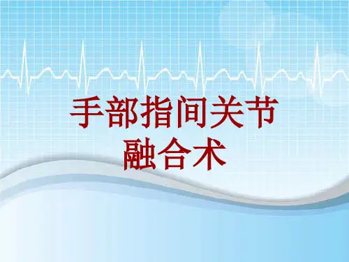 外科手术教学资料：手部指间关节融合术讲解模板