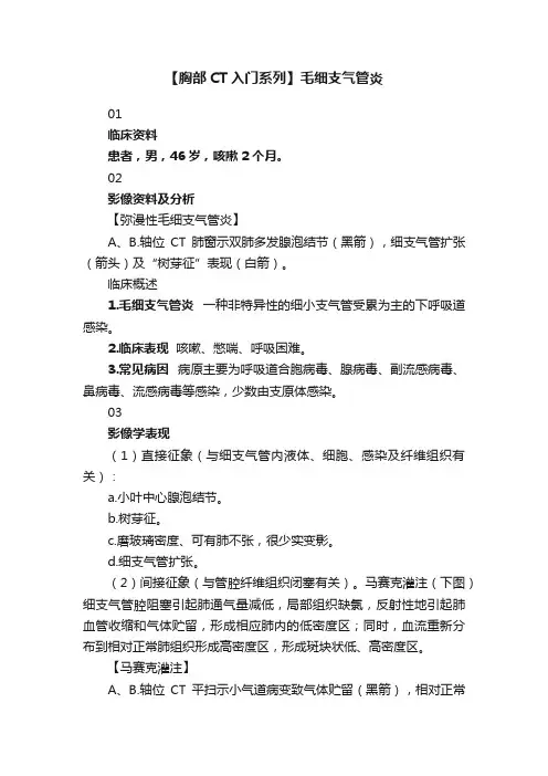 【胸部CT入门系列】毛细支气管炎