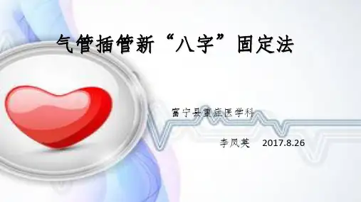 气管插管八字固定法完整ppt课件