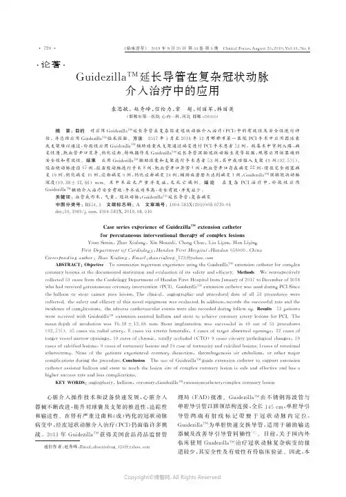 GuidezillaTM_延长导管在复杂冠状动脉介入治疗中的应用