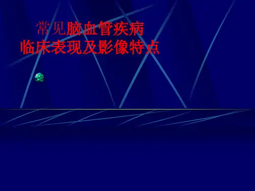 常见脑血管病临床及影像特点