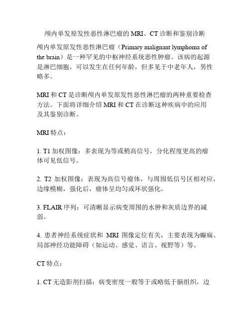 颅内单发原发性恶性淋巴瘤的MRI、CT诊断和鉴别诊断