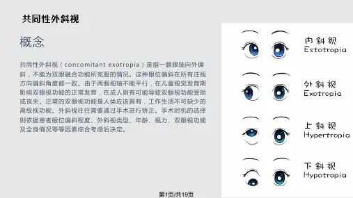 斜视教学查房PPT课件