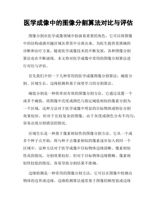 医学成像中的图像分割算法对比与评估