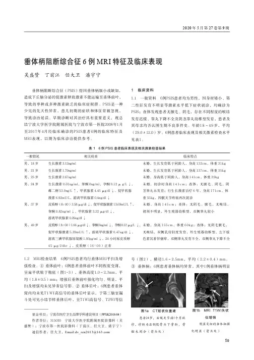 垂体柄阻断综合征6例MRI特征及临床表现