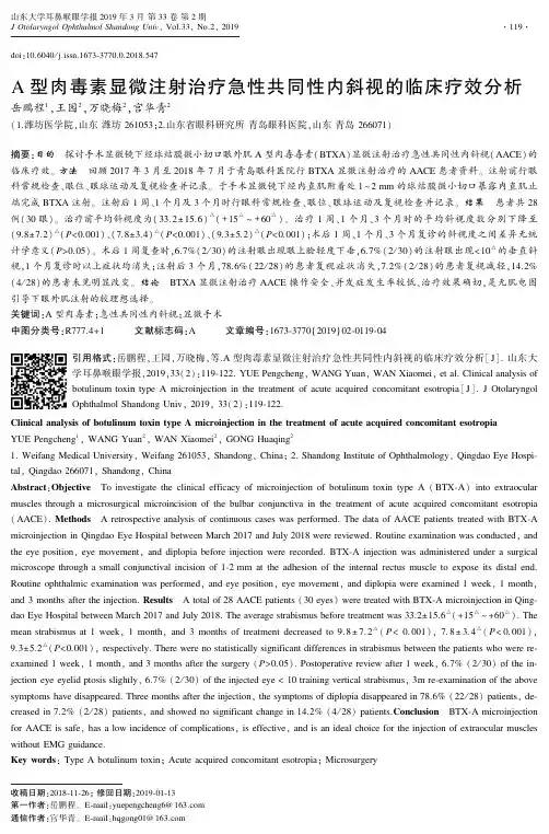 Ａ 型肉毒素显微注射治疗急性共同性内斜视的临床疗效分析
