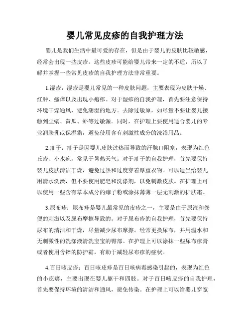 婴儿常见皮疹的自我护理方法