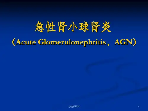 小儿急性肾小球肾炎ppt课件