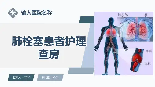 肺栓塞患者护理查房ppt课件
