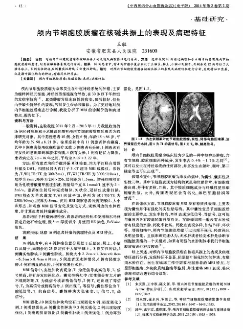 颅内节细胞胶质瘤在核磁共振上的表现及病理特征