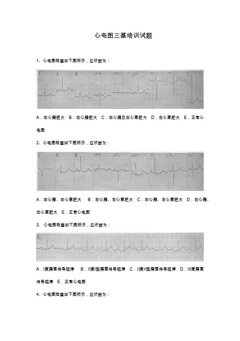 三基培训心电图试题