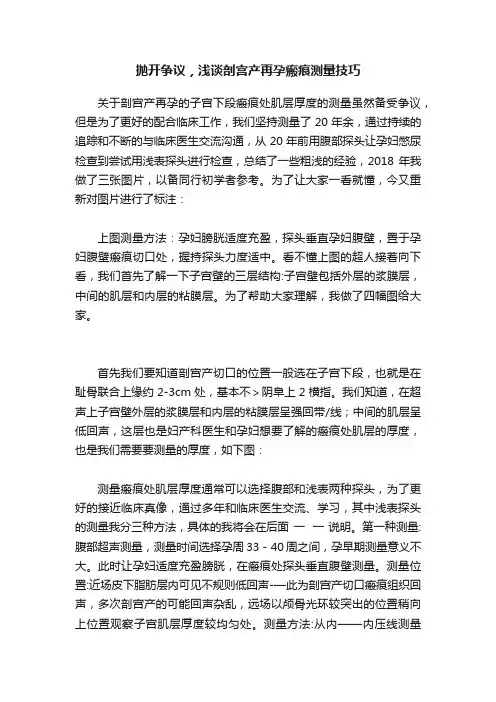 抛开争议，浅谈剖宫产再孕瘢痕测量技巧