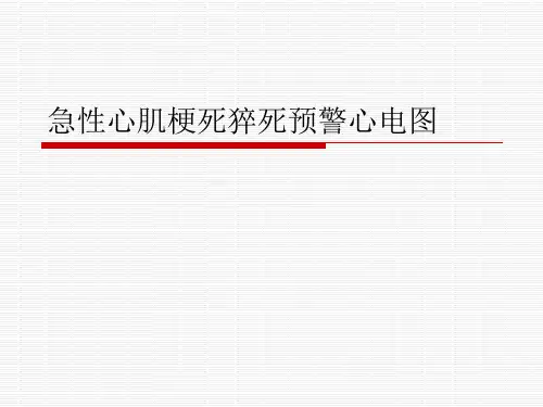 急性心肌梗死猝死预警心电图【78页】