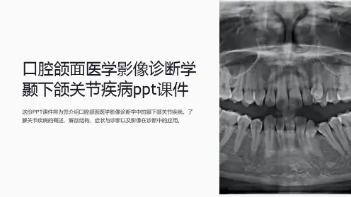 口腔颌面医学影像诊断学颞下颌关节疾病ppt课件