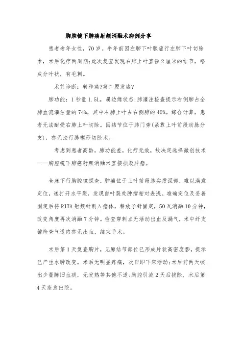 胸腔镜下肺癌射频消融术病例分享