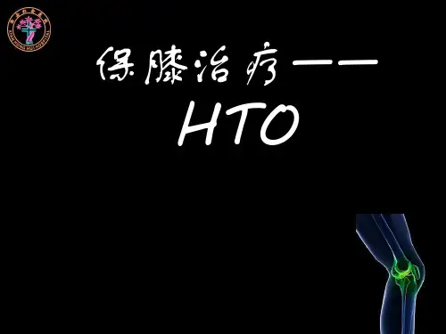 HTO