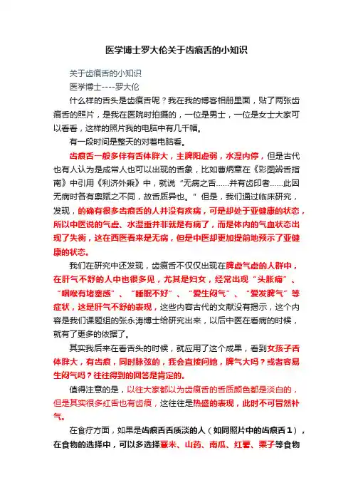 医学博士罗大伦关于齿痕舌的小知识