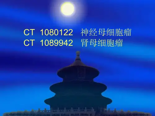 肾母细胞瘤与神经母细胞瘤