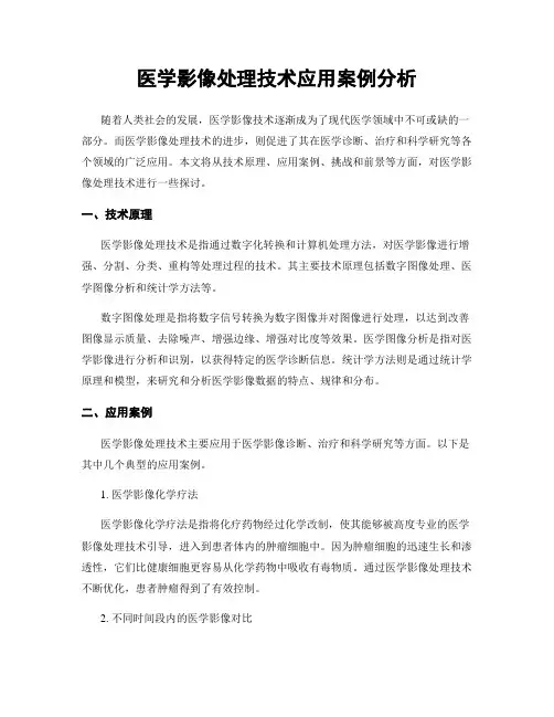 医学影像处理技术应用案例分析