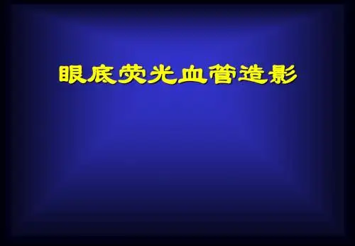 眼底荧光血管造影相关知识