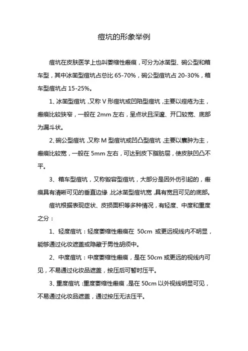 痘坑的形象举例
