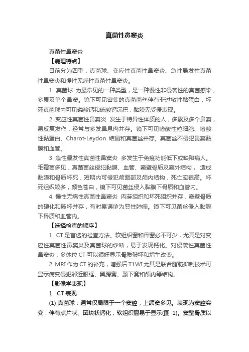真菌性鼻窦炎